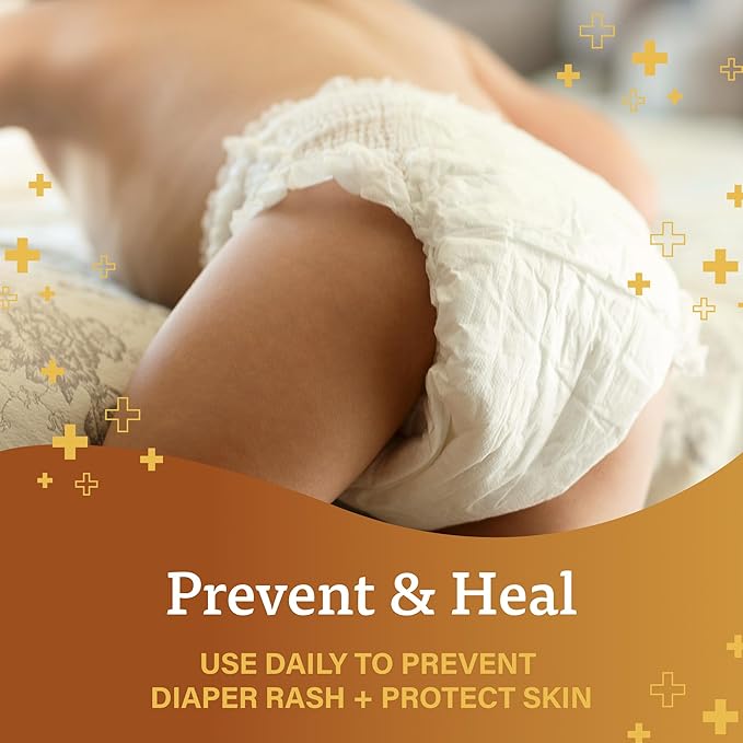 A+D Original Diaper Rash Ointment, Baby Skin Protectant with Lanolin and Petrolatum, Seals Out Wetness, Helps Prevent Diaper Rash, 1.5 Ounce Tube, Packaging May Vary